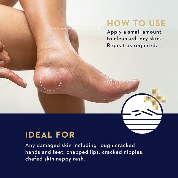 Alternative view of Manuka Health, Manuka Rescue Balm, 1.69 fl oz (50 ml)